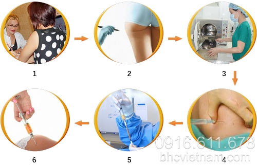 Cách độn mông khi bị chảy xệ