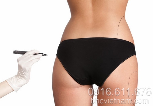 Bơm mông bao nhiêu tiền và nó có ưu điểm gì?